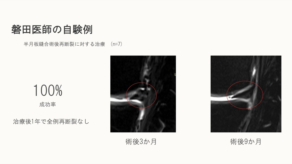 臨床治療成績4