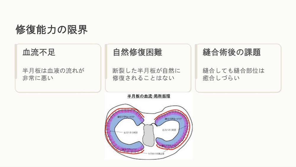 半月板基礎4