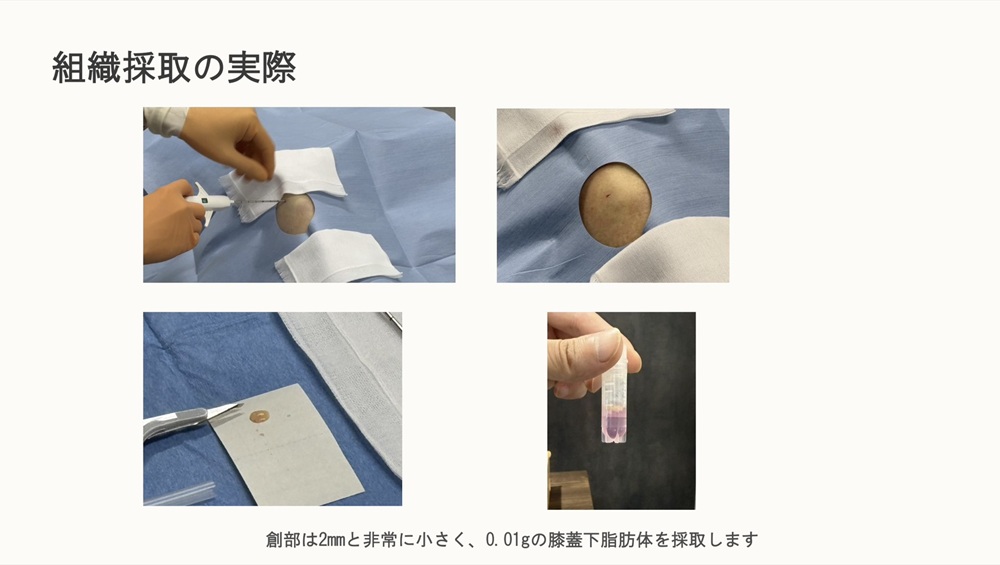 治療開始の手続き4
