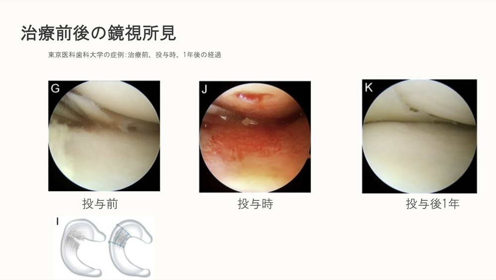 臨床治療成績3